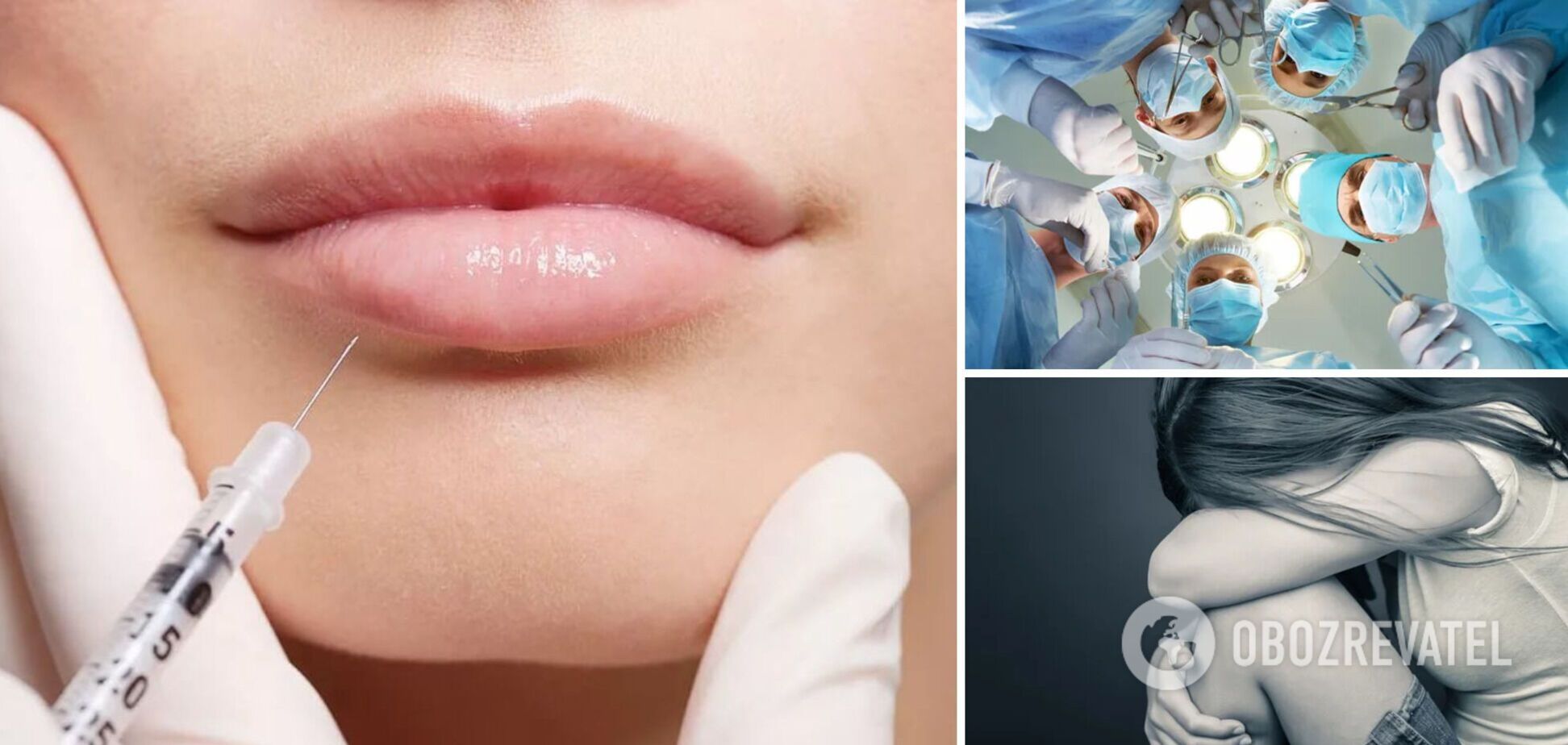 У Дніпрі лікарі рятують дівчину, яка зробила собі укол у губи